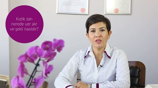 Kızlık zarı nerededir? Şekli nasıldır?